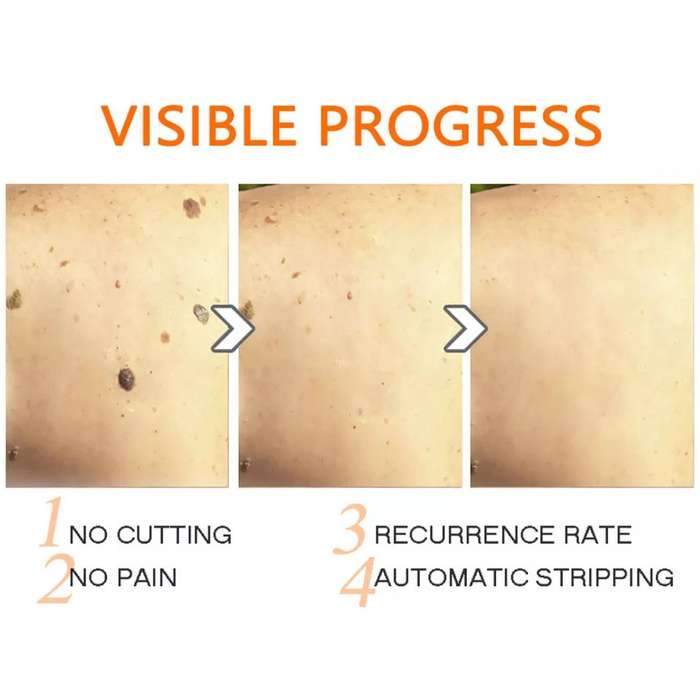 LumiDerm™ Belleza Natural